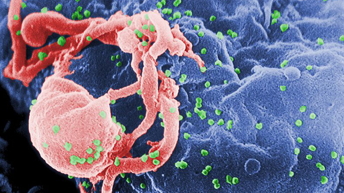 HIV virus (image from http://phil.cdc.gov, Photo Credit: C. Goldsmith)