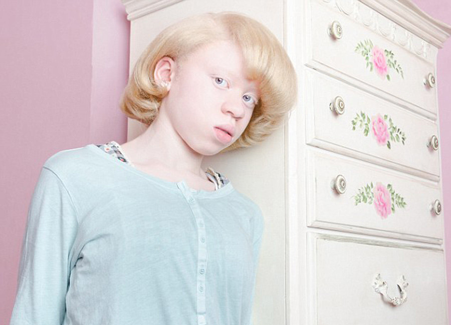 One in 20 000 Extraordinary albino beauty revealed in 