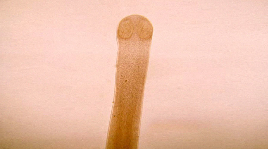 'Holy moly, a tapeworm!' Man dies after parasite inside him developed cancer