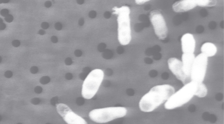 ‘Almost too late’ to halt spread of antibiotic resistant bacteria found in pigs – scientists