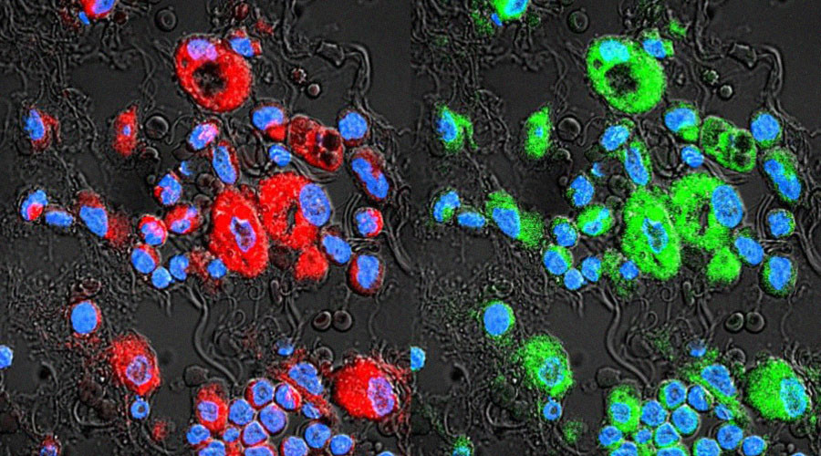 ‘Invisibility cloak’ for chemo: Lung cancer treated with one-fiftieth of usual dose