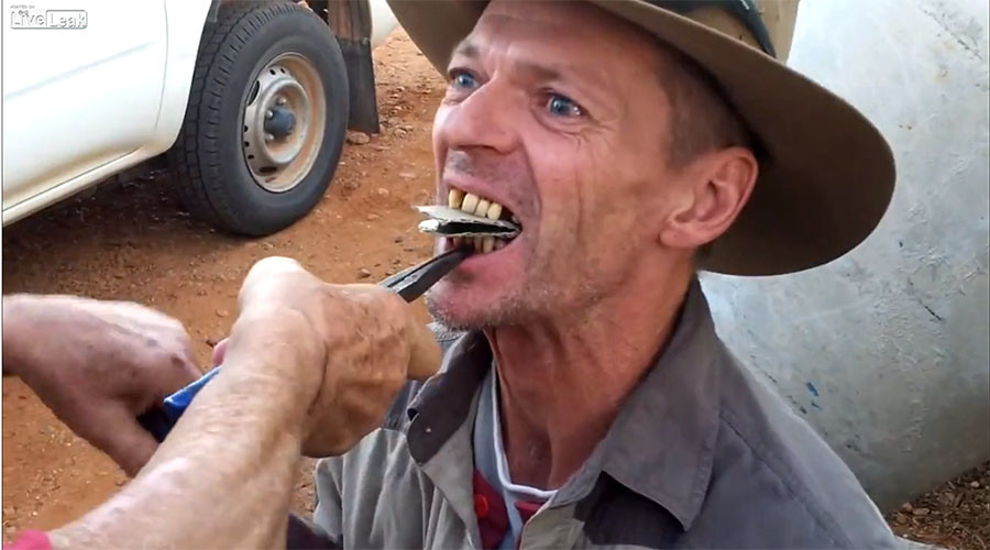 Flamin’ hell! Outback ‘dentist’ pulls teeth old-fashioned way