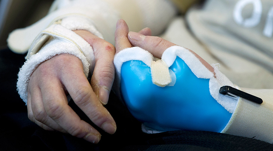 High five! Hand transplants offered for free on NHS