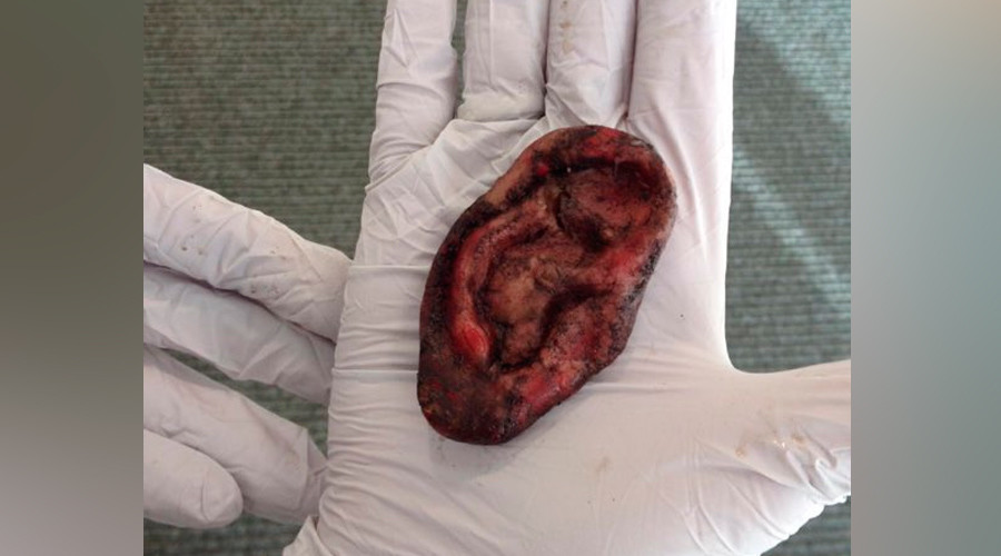 ‘Nothing to see ear’: UK Police called over fake severed ‘human’ lobe