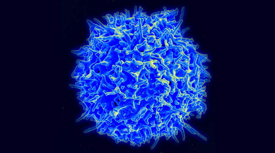 T-cell therapy shows 'extraordinary' results in patients with terminal blood cancer
