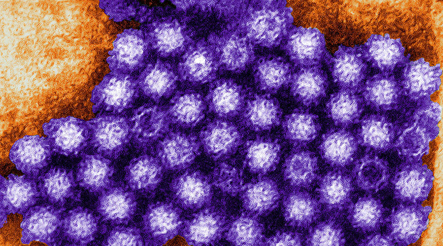 Norovirus infections spread to more college students in Michigan and Ohio