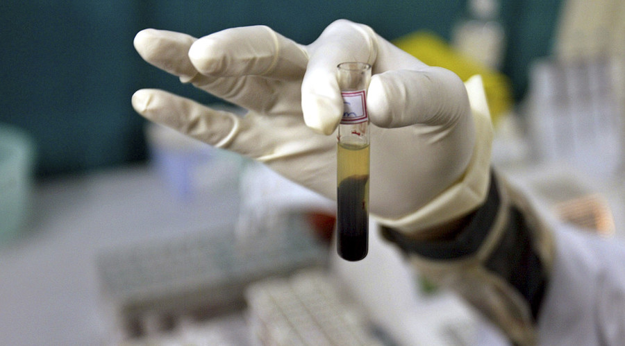 200+ New Jersey hospital patients feared exposed to HIV, hepatitis B or C