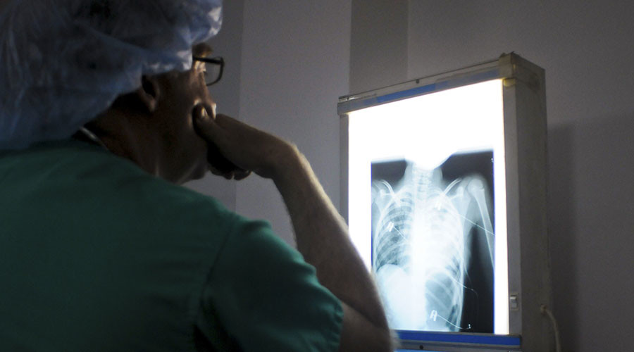 No bones about it: Yale surgeon removes wrong rib, accused of cover-up