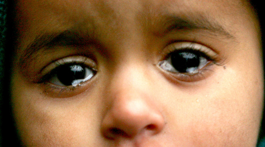 Breadline Britain: Rising malnutrition & death linked to low wages, welfare cuts