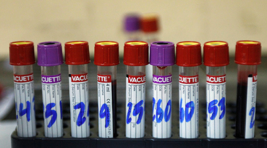 US reports first Zika death as FDA approves emergency test for virus