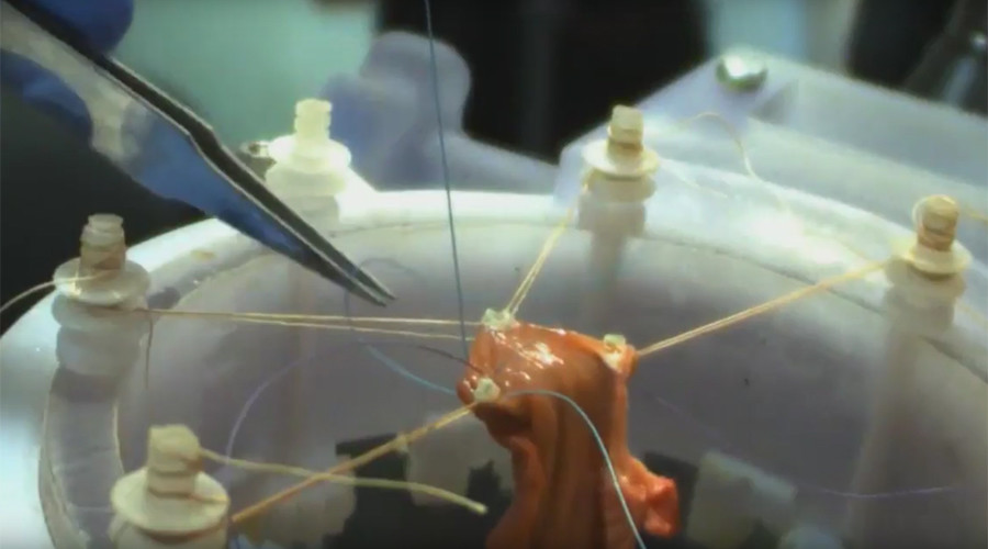Robot performs soft-tissue surgery without human operator