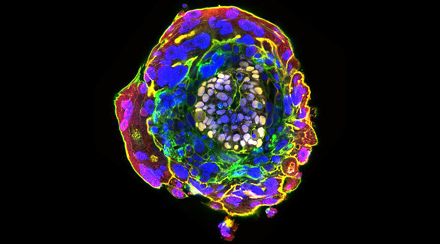 13-day-old human embryo grown in lab for controversial record-breaking study