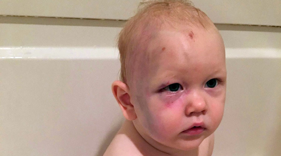 #JusticeforJacob: Massive online support for 1yo beaten by babysitter who walked free