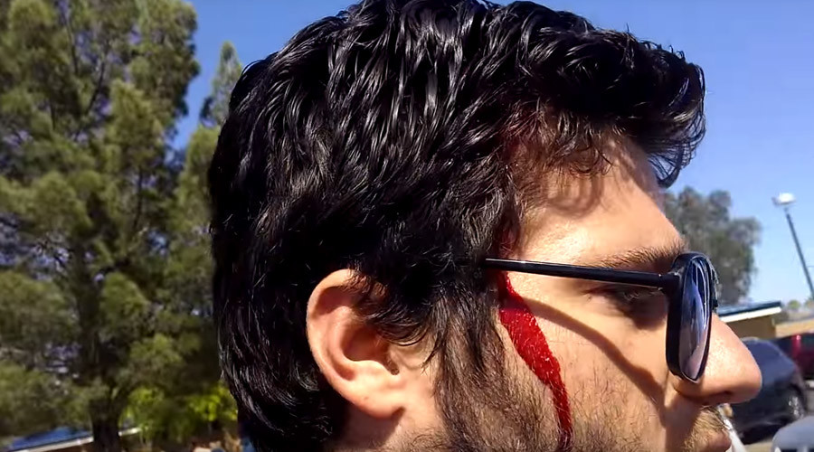 Hate preacher carrying ‘you deserve to be raped’ sign hit over head with baseball bat (VIDEO)