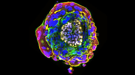  An image of a human embryo at day 11 of development © University of Cambridge