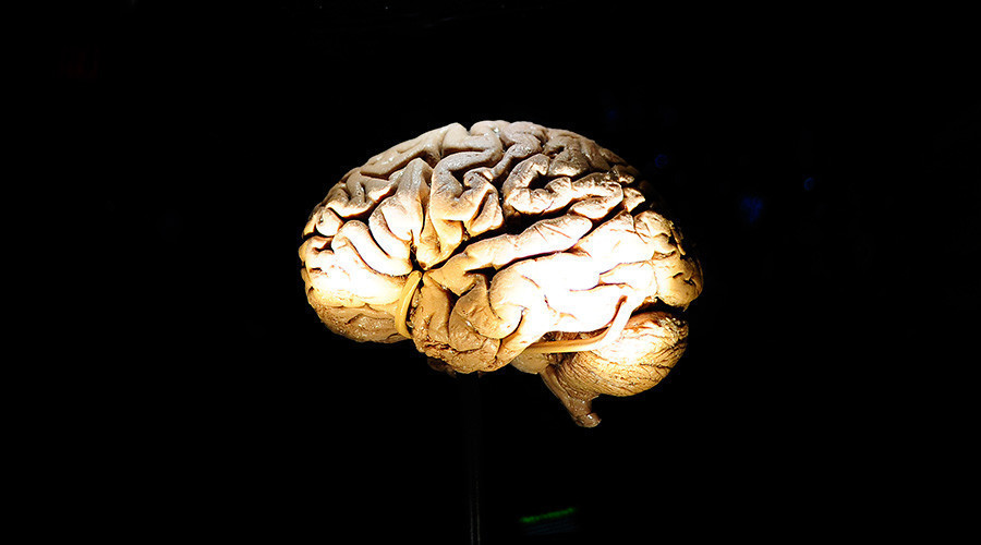 File photo of a human brain. © Emmanuel Dunand