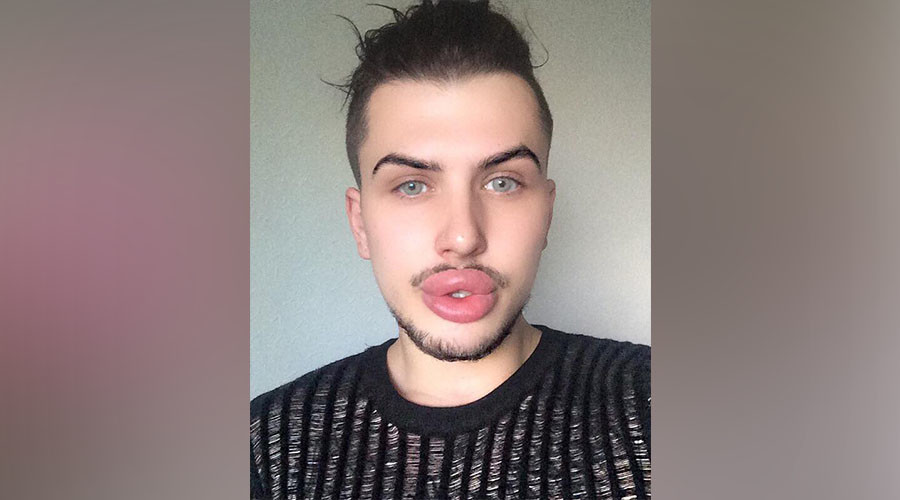 Kardashian-obsessed man spends £20k on cosmetic surgery to look like celebrity idols