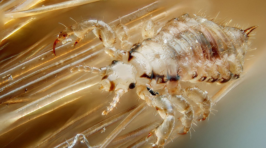Mutant ‘super lice’ US outbreak here just in time for back-to-school