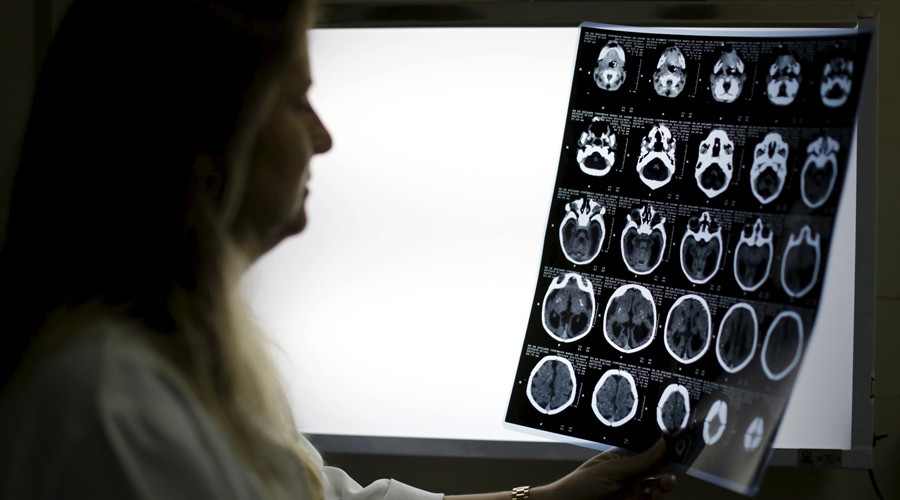 Science of kindness? Generosity linked to specific part of brain, study says
