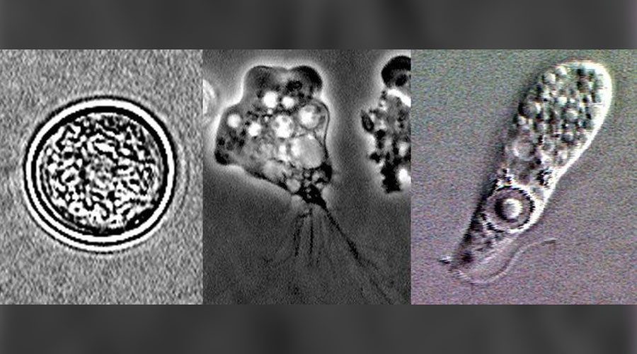 Florida resident contracts dangerous brain eating amoeba, the 4th US case this year