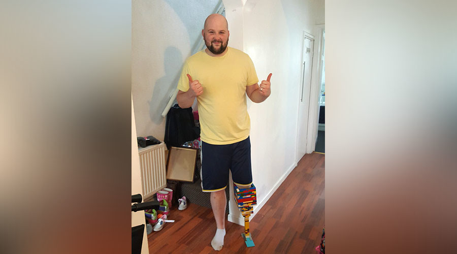 Amputee builds himself Lego leg while waiting for prosthetic limb