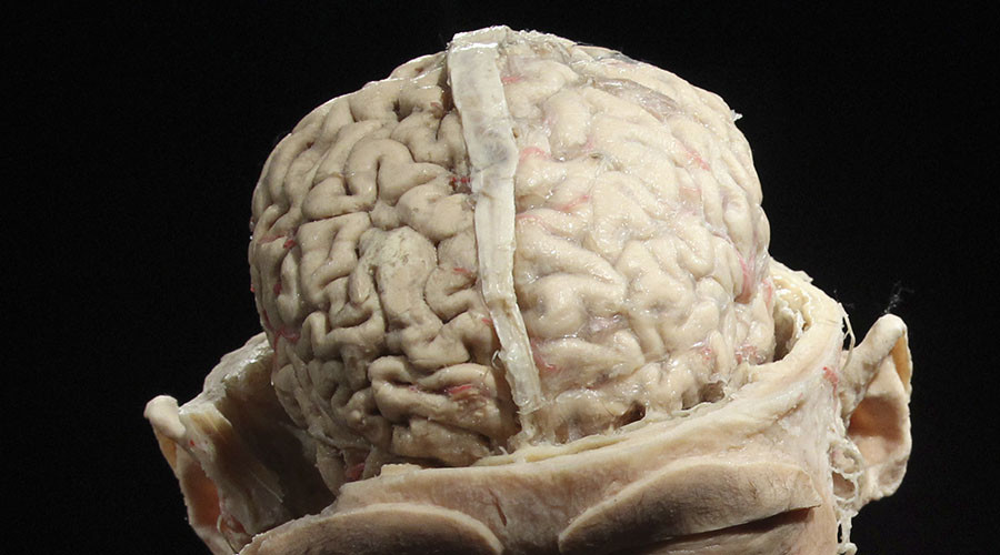Science Museum gets a piece of visitors’ minds after male/female brain comparison