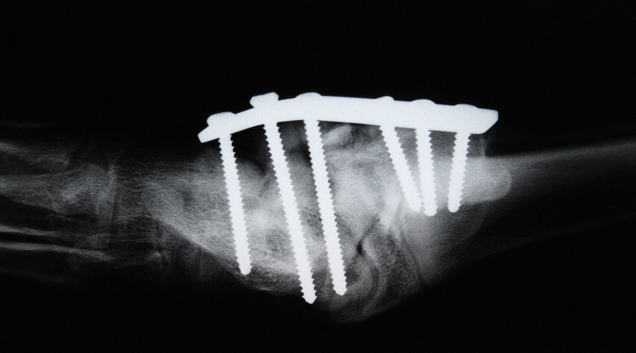 Bone in the USA: Researchers 3D print potential replacement skeleton parts