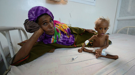 A woman rests on a bed next to her malnourished son at a hospital in the Red Sea port city of Houdieda, Yemen Setember 9, 2016. © Abduljabbar Zeyad