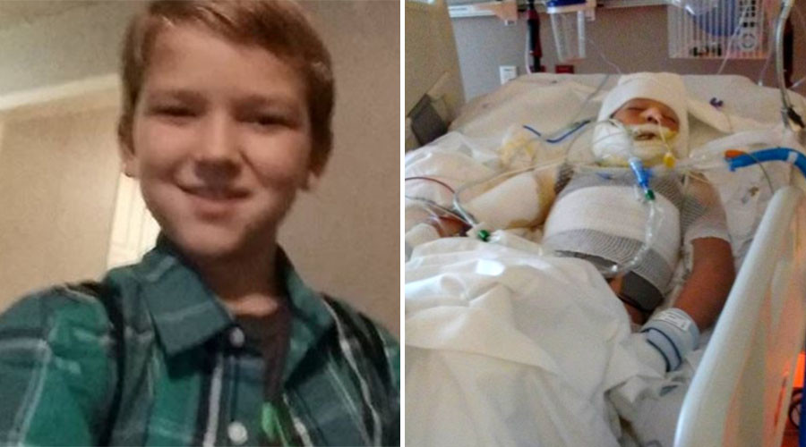 10yo boy with special needs in critical condition after being set on fire