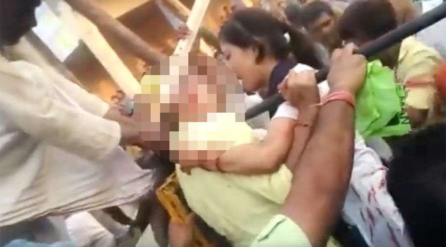 Teen’s hair ripped clean off head in bloodcurdling ferris wheel selfie bid (GRAPHIC VIDEO)
