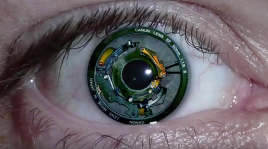 New bionic eye implant connects directly to brain, allowing blind woman