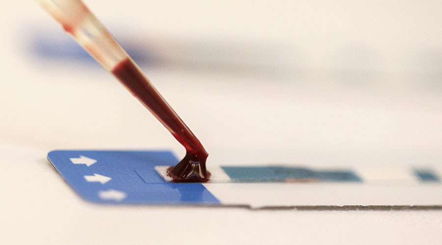HIV 'epidemic': Official says nearly every 50th resident of Russian Urals city infected
