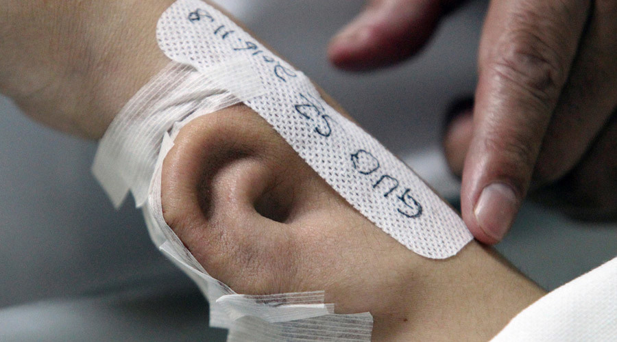Man grows ear on arm in breakthrough surgery (IMAGES)