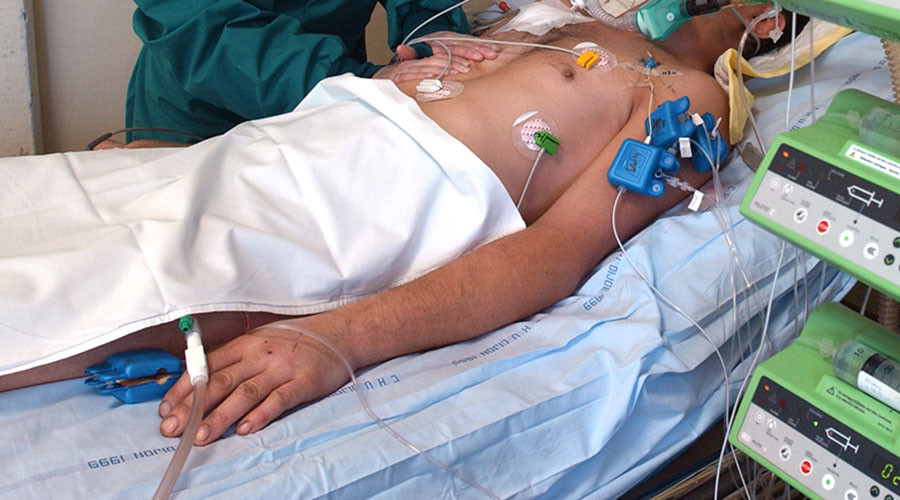 India derails trial to revive brain-dead accident victims amid controversy