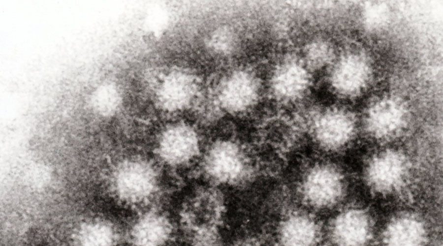 166 children fall ill with vomiting bug in major outbreak at same English primary school