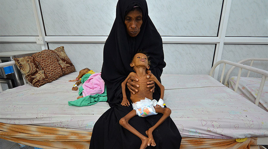 Child malnutrition at ‘all-time high’ in Yemen, UNICEF claims in alarming report