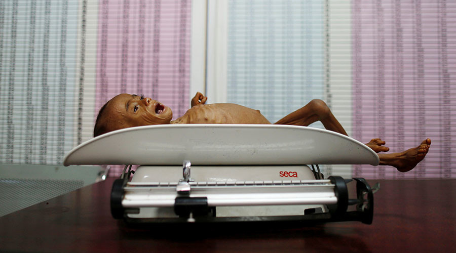 #SOS_YemenGenocide: Tragic photos of war-torn country shared online