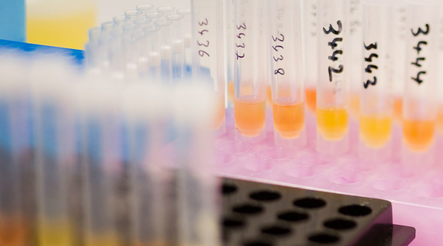 ‘Anti-doping agencies should collect urine, not meddle in politics’ – Russian Deputy PM Mutko