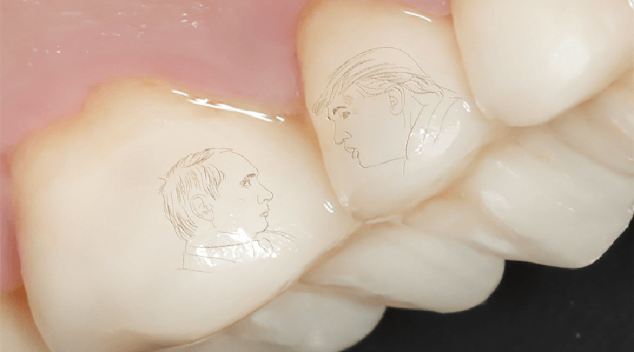 Forget gold teeth, Putin-Trump dental crowns is now a thing in Russia (PHOTOS)