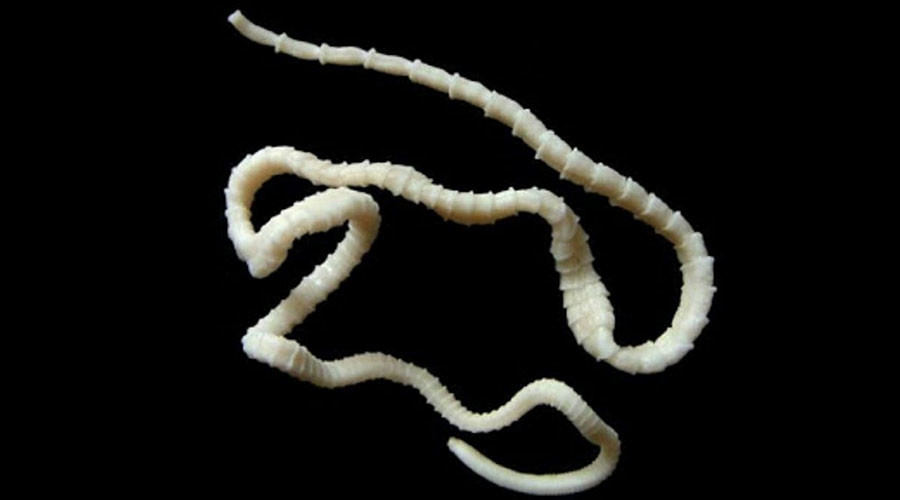 Mammoth 6ft live tapeworm removed from man’s gut through his mouth (GRAPHIC PHOTOS)