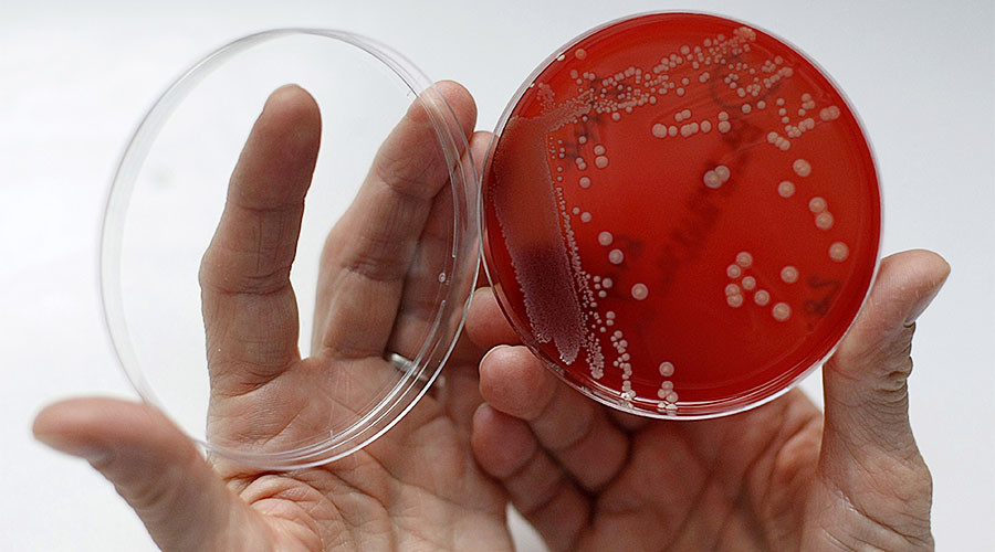Drug-resistant superbug sent to space for study – NASA