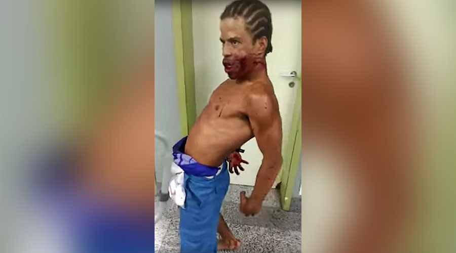 Eerie ‘possession’ footage shows bloodsoaked gunshot victim claim he works with devil (GRAPHIC)