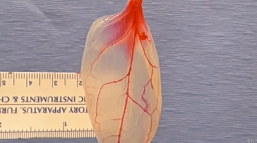 Turning over a new leaf: Spinach used as functional human heart tissue in study