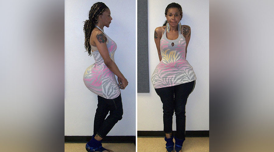 Bogus doctor jailed for 10 years after providing fatal buttock injections