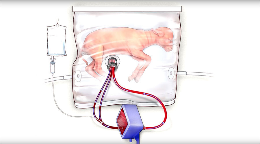 Artificial wombs successfully pass 1st test, human trials could begin within 3yrs (PHOTOS)