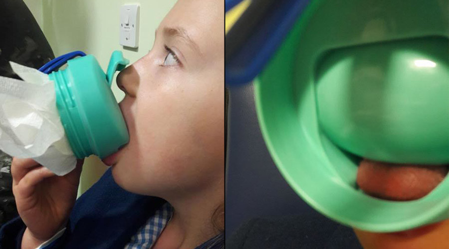 7yo girl's tongue removed from Disney mug with hacksaw