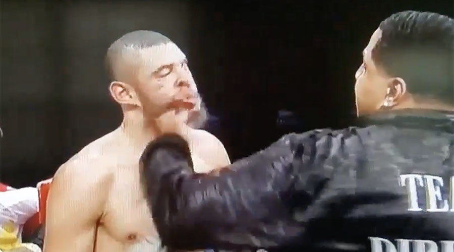 Boxer Dirrel apologizes after uncle punches opponent