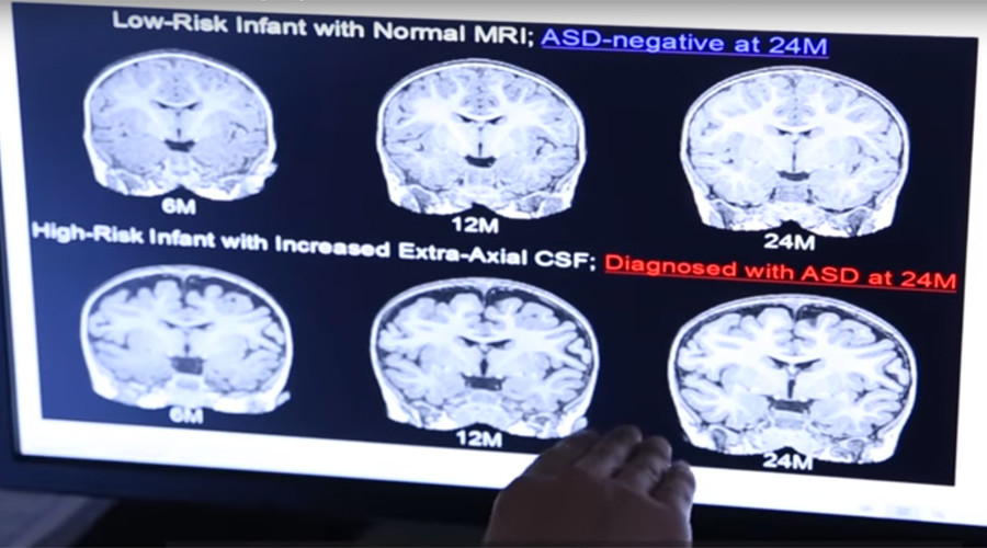 AI machine can spot autism in babies as young as 6 months – study