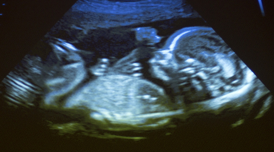 Babies drawn to face-like shapes while still in womb – study