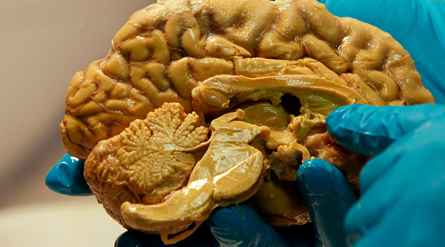 Pig cell implants could hold key to alleviating Parkinson’s symptoms